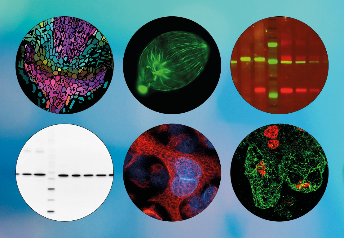 Antibody techniques