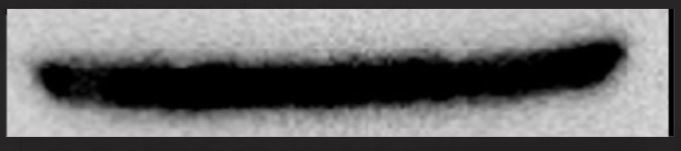 Why bands on the blot can not be distinguished from each other?