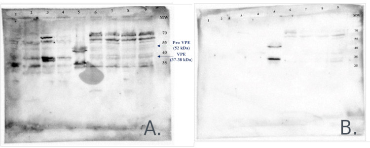 Effect of membrane wash on background signal in Western blot