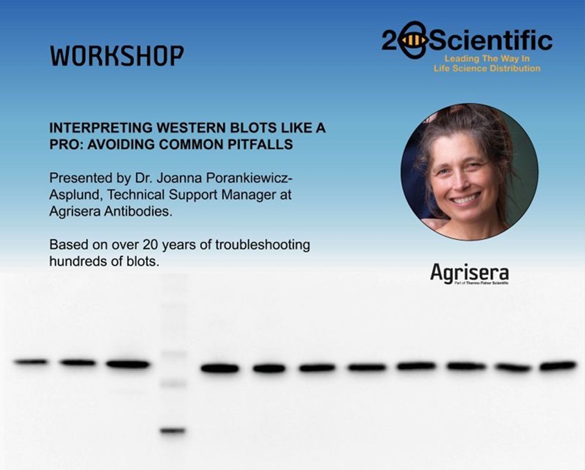 Interpretation of Western blot results, workshop with 2B Scientific