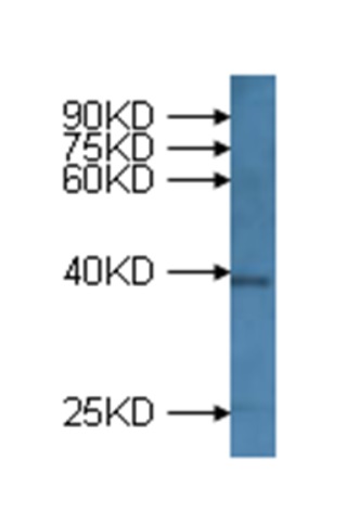 western blot using anti-mitogen activated protein kinase 33