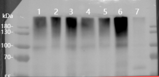Protein aggregates at a top of a gel