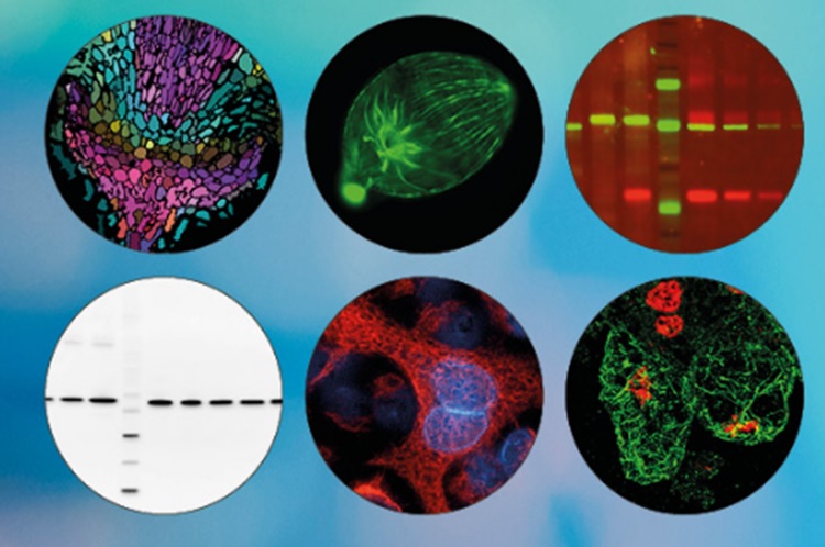 Antibody techniues 